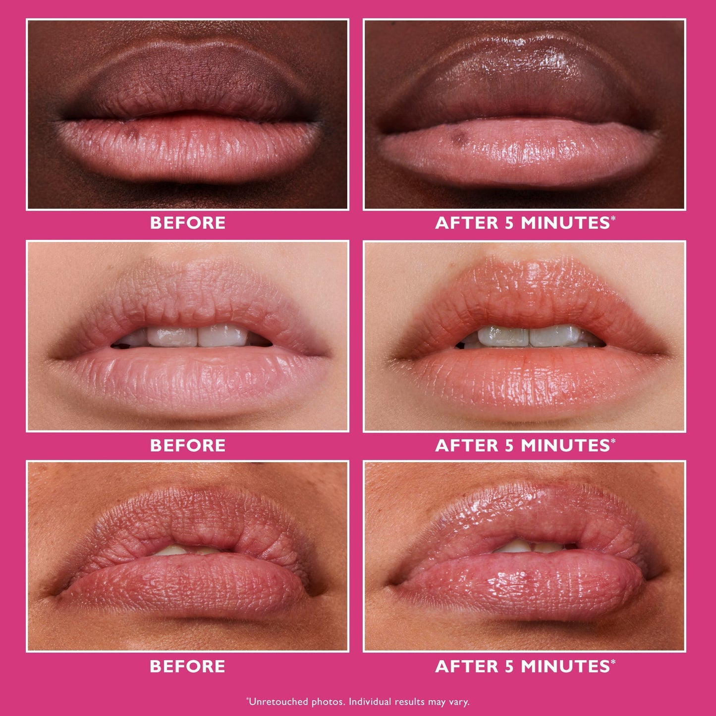 Instant FIRMx Lip Filler|10 ml / 0.3 fl oz